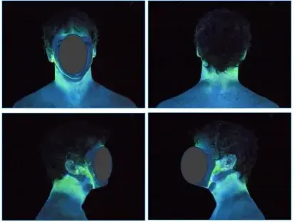 (4 images cropped together) Test subject with demonstration of particulate buildup on face and neck under a black light.