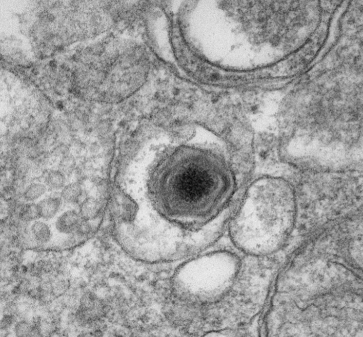African swine fever virus infects a macrophage, a type of white blood cell. Electron microscope image by Ben Clark, PIADC.