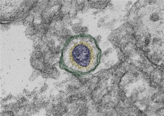 Transmission electron microscope picture of a section of an animal culture cell (grey) with a single coronavirus (center – yellow, purple) surrounded by a vesicle (green). Photo by DHS.
