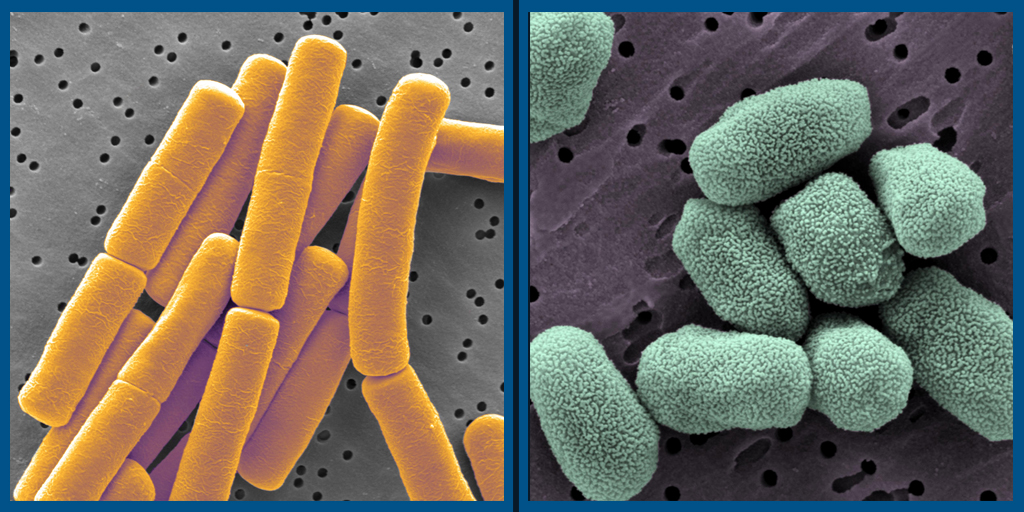 Anthrax bacteria (left) and their spores (right). Scanning electron microscope pictures by NBACC.