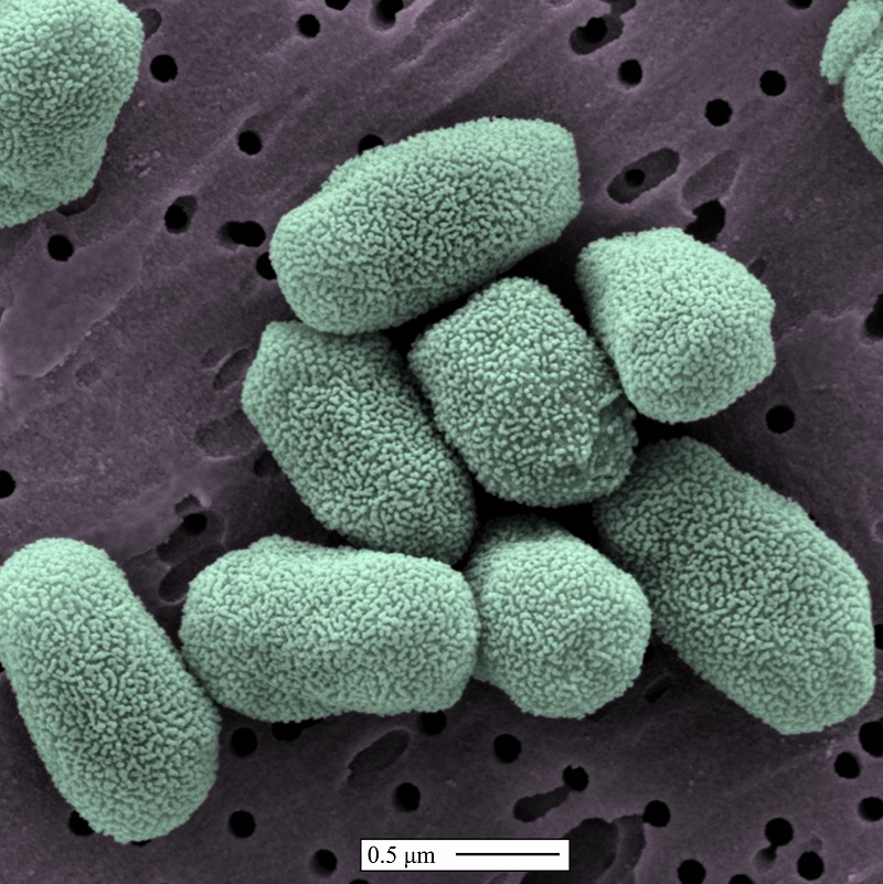 A scanning electron microscope picture of anthrax spores. Magnification 45,000 times. Image: S&T National Biodefense Analysis and Countermeasures Center.