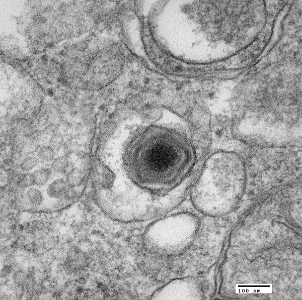 African Swine Fever virus infects a pig macrophage, a type of white blood cell. Electron microscope image by Ben Clark, PIADC