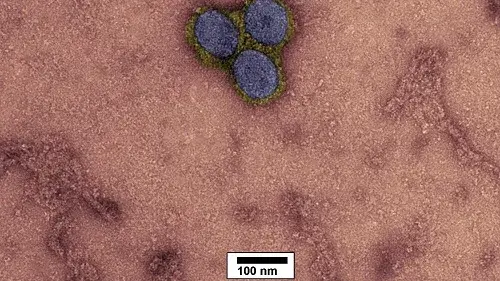 Negative stain transmission electron micrograph of SARS-CoV-2 (blue capsid, yellow surface proteins). Magnification: 200,000X.