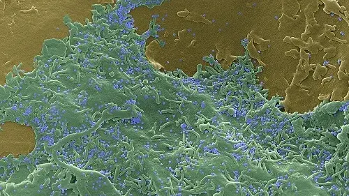Scanning electron micrograph of the surface of a SARS-CoV-2 infected Vero cell (green), surrounded by less infected Vero cells (tan). SARS-CoV-2 can be seen budding from the surface and bound to the surface (blue). Magnification: 16,750X.